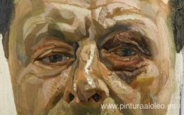 Autorretrato con ojo morado
