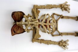 El hombre de las orejas de cerdo. El hombre de las orejas de cerdo.