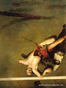 Amputación Amputación